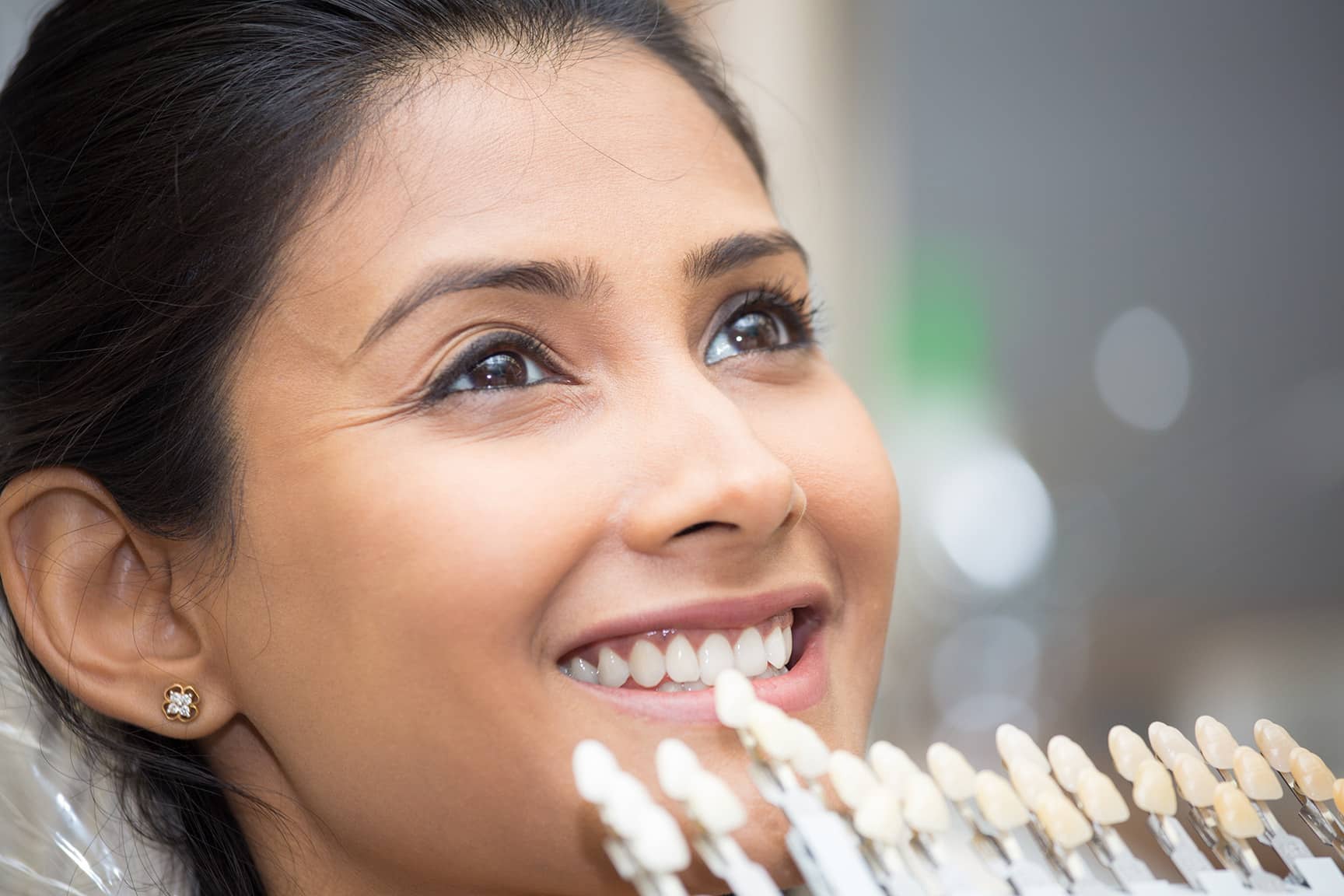 Porcelain veneers Magnolia Dental Group in TN