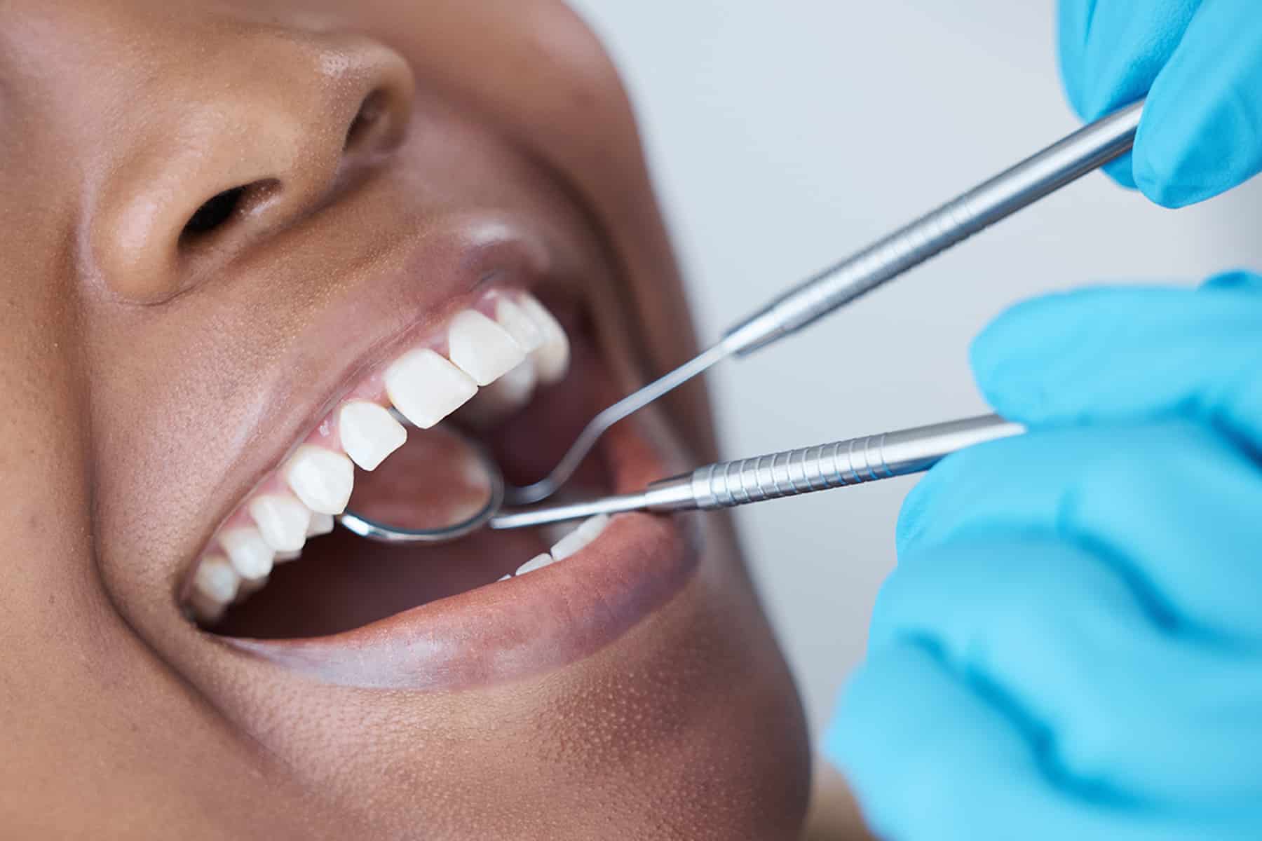 Person getting an oral cancer screening in Murfreesboro, TN