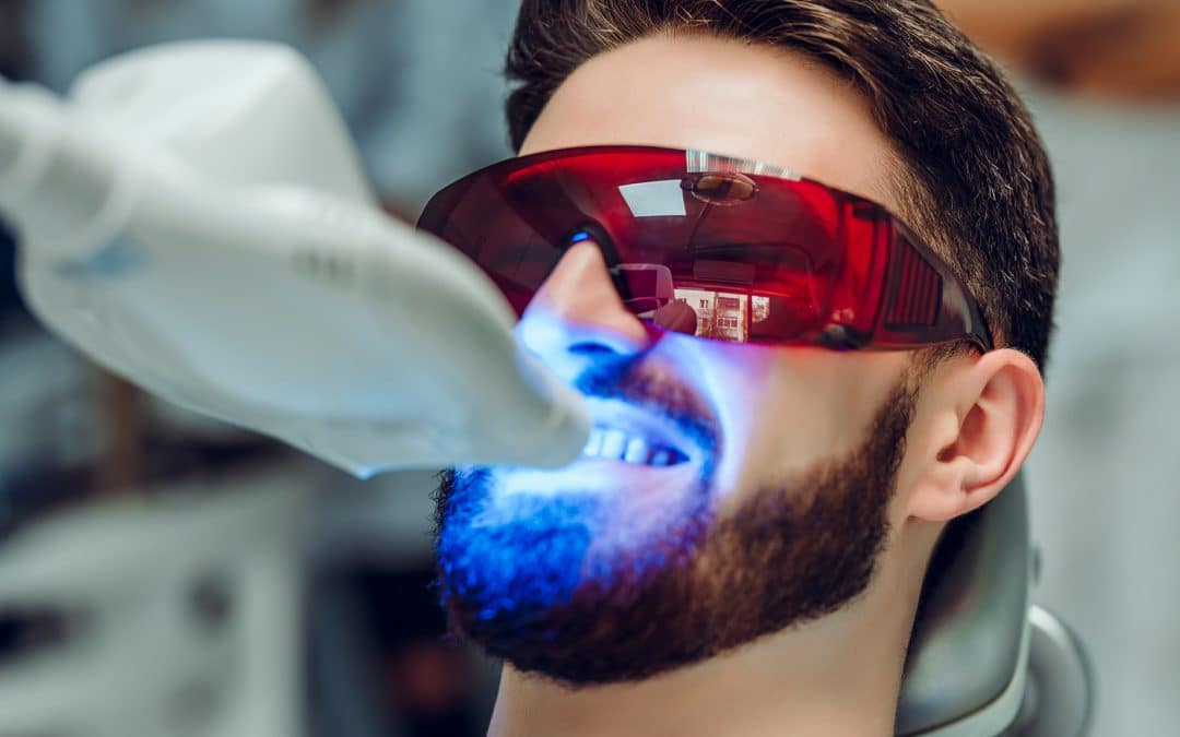 Understanding Professional Teeth Whitening: Achieving a Brighter Smile